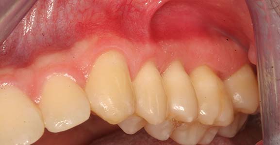 Oral Pathology After Cropped Oral Pathology After