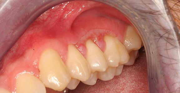 Oral Pathology Before Oral Pathology Before